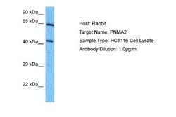 PNMA2 Rabbit anti-Human, Polyclonal, Novus Biologicals 0.1ml; Unconjugated:Antibodies,